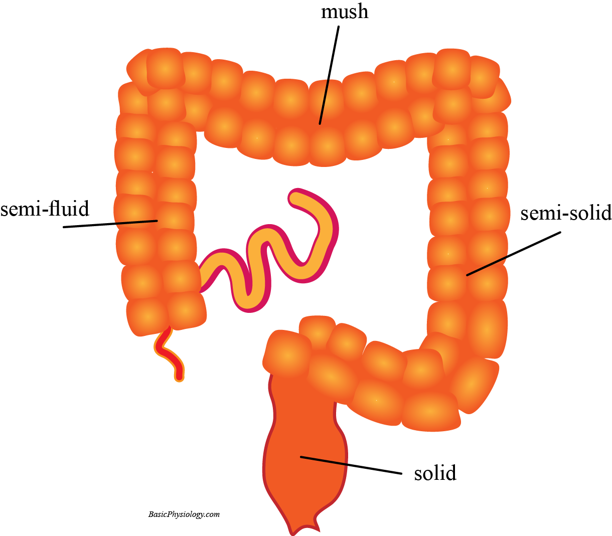 Gradual transition of the chime in the colon; from semi-fluid to semi-solid 